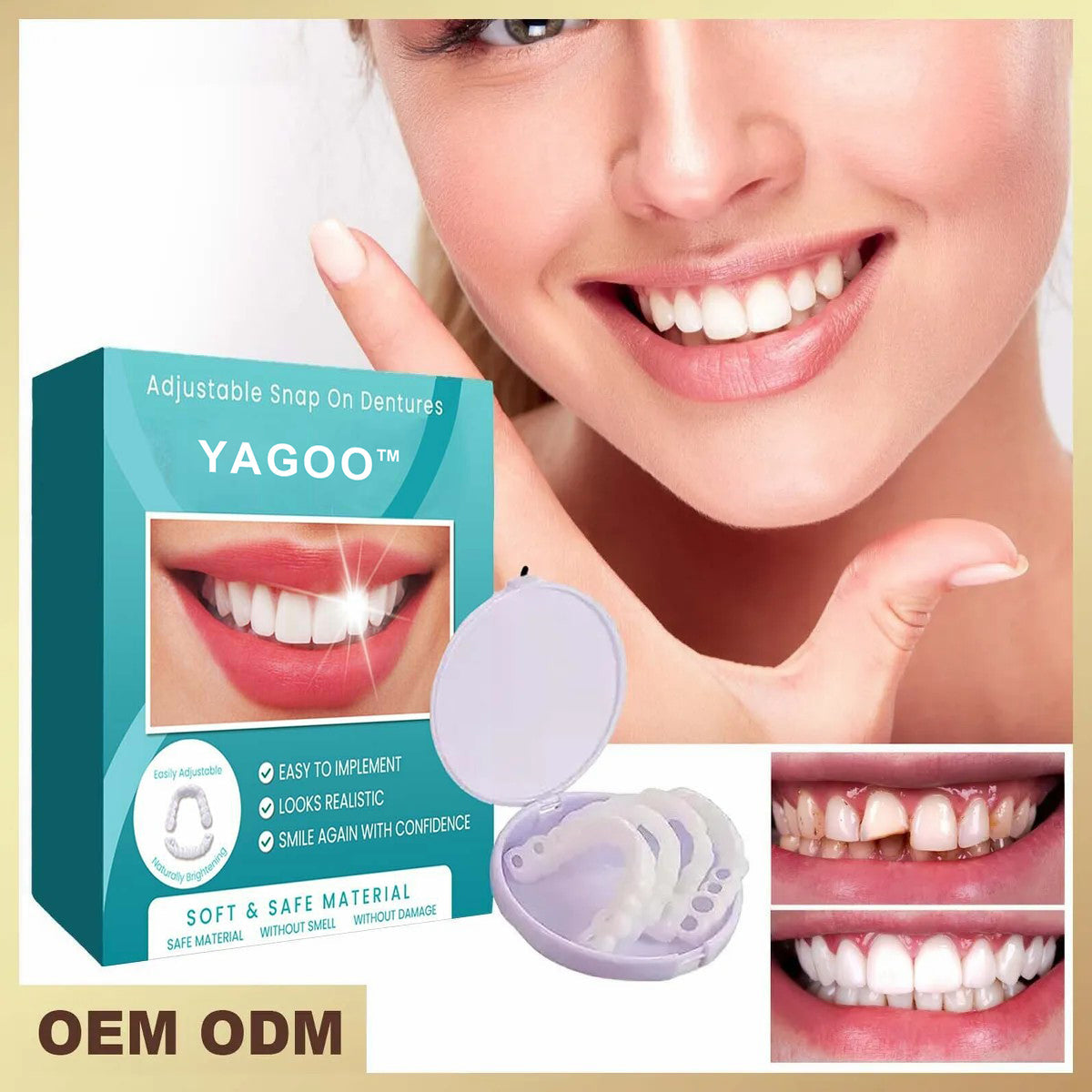 💝Last day discount-75%Off💝Latest👨‍⚕Adjustable Snap-On Dentures😁