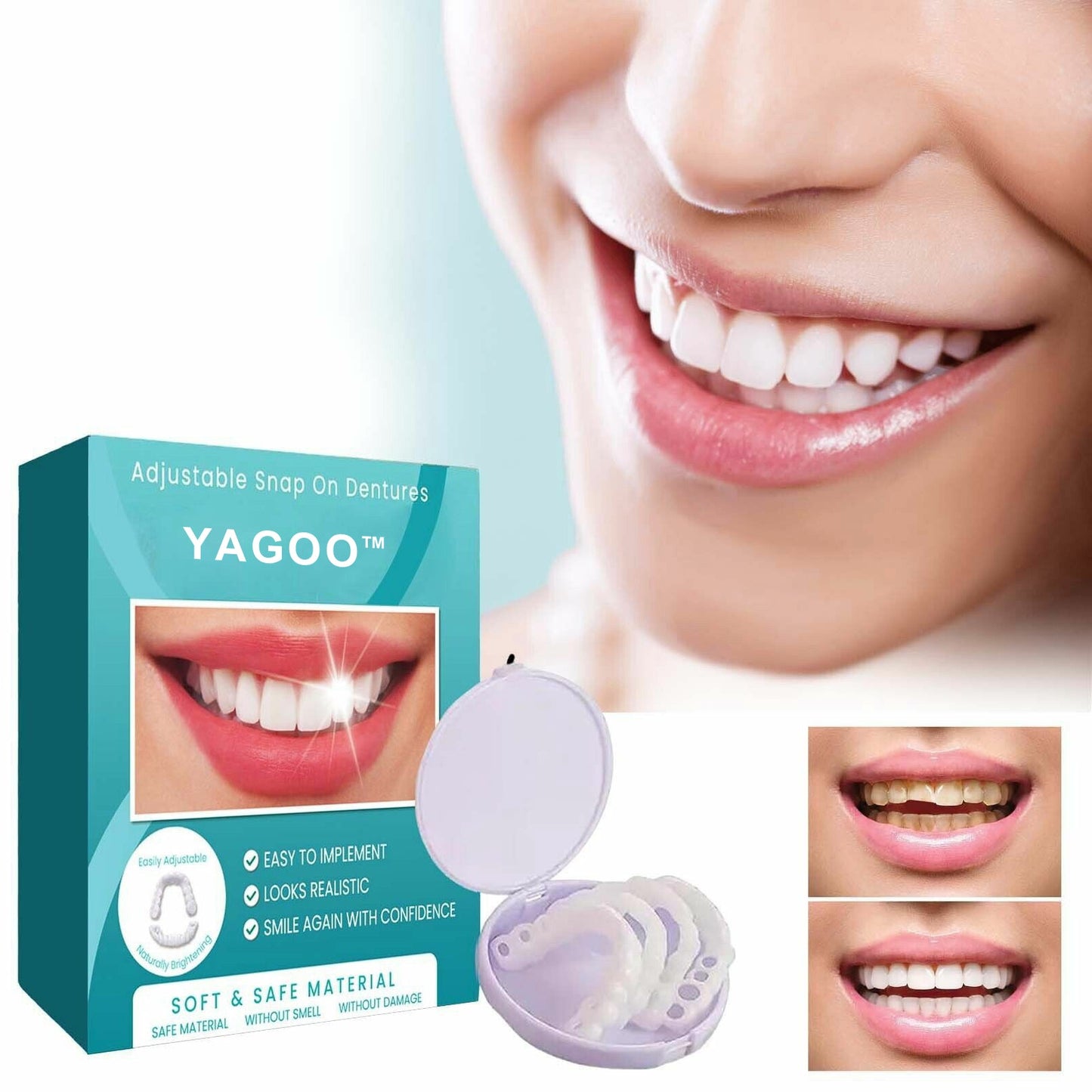 💝Last day discount-75%Off💝Latest👨‍⚕Adjustable Snap-On Dentures😁