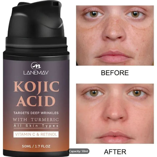 KOJIC ACID – Skin Whitening