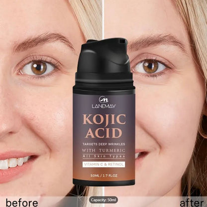 KOJIC ACID – Skin Whitening